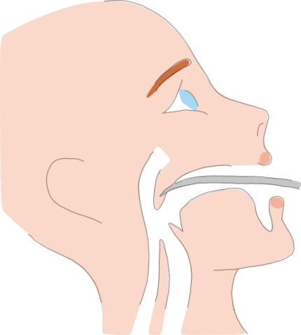 Radio-frequency ablation for snoring Radio-frequency ablation for snoring